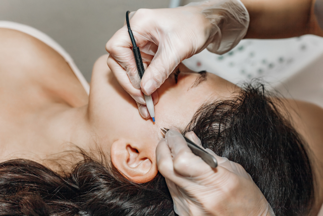 Electrolysis Hair Removal